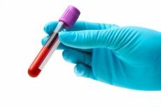 A gloved hand holds a blood collection tube with a purple cap against a white background.