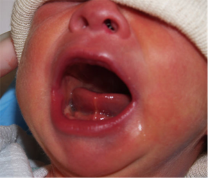 Close-up of a newborn with an open mouth, showing the tongue and gums.