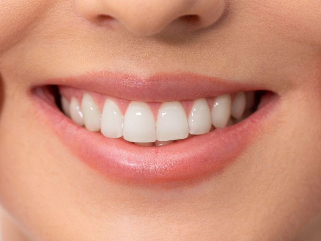 periodontal therapy  image