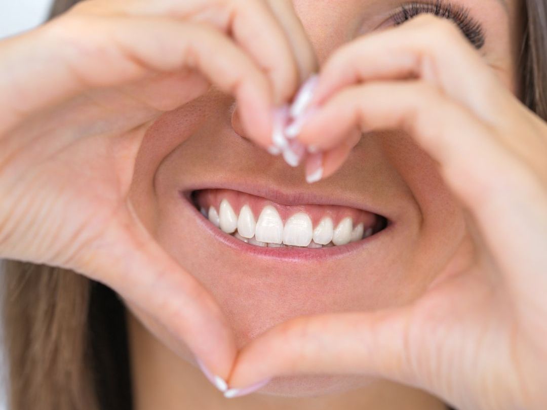 smile makeover image