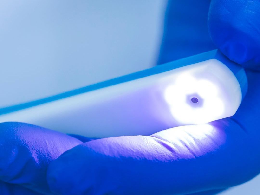 dental checkup image