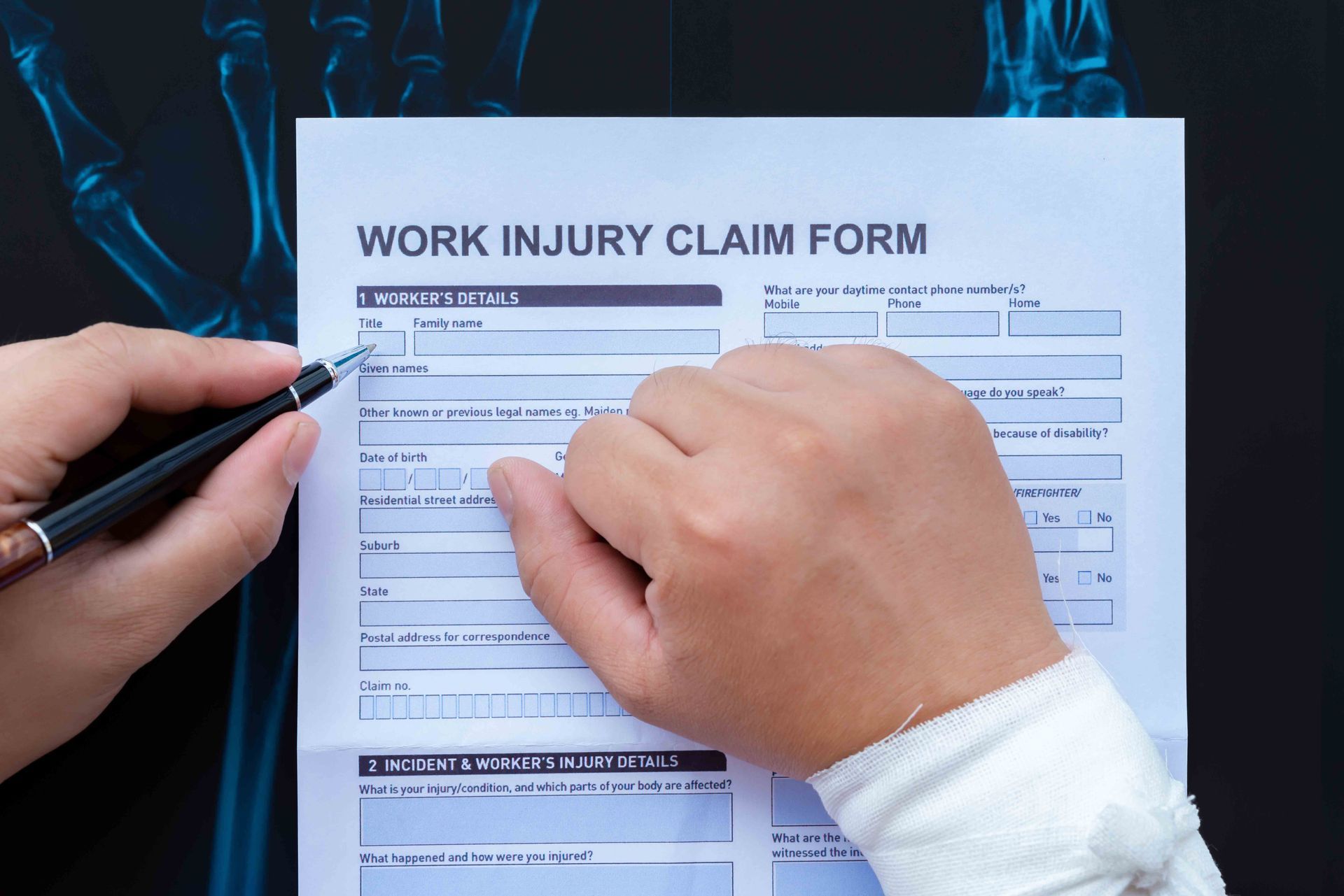 filling up a work injury claim form with a wrapped hand on top of an X-ray film medical and insurance concept filling up a work injury claim form with a wrapped hand on top of an X-ray film medical and insurance concept