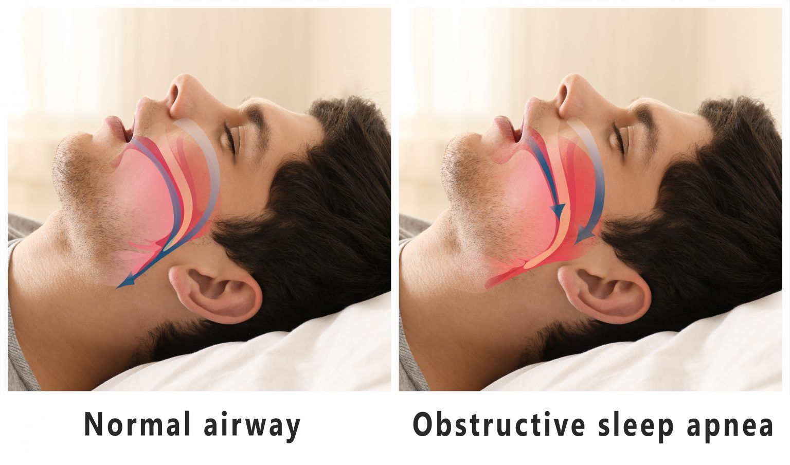 woman having an invisalign