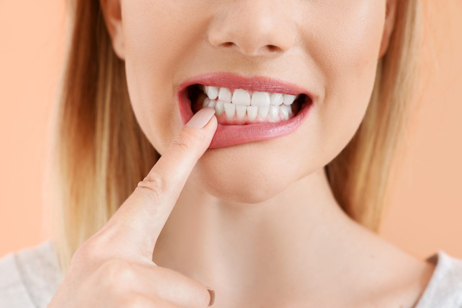 ROOT CANALS