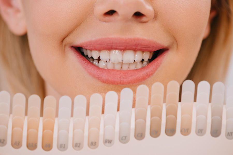 smiling woman in dental clinic | Custom teeth whitening in Monroe Township, NJ for a brighter smile.