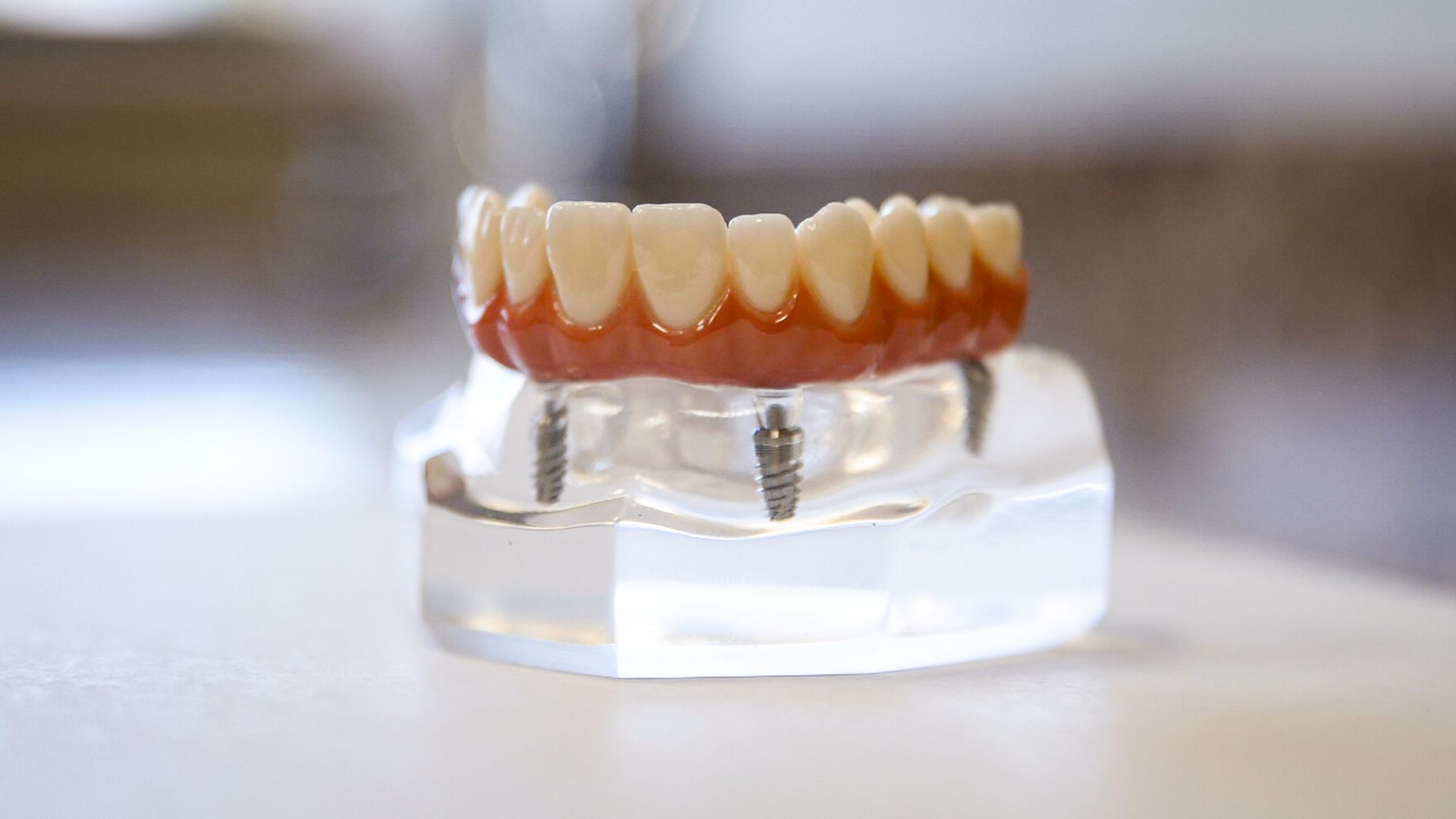 dental machine