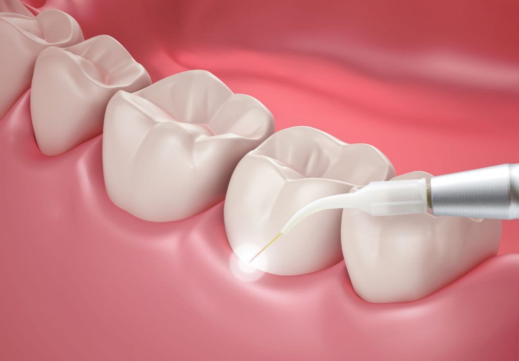 woman having a dental checkup