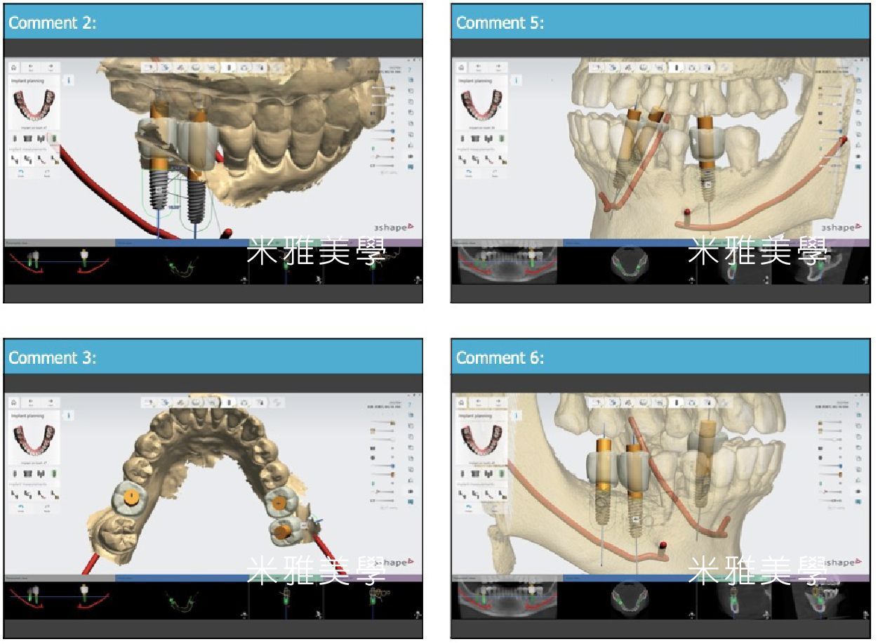 Four images of a skull and teeth on a computer screen.