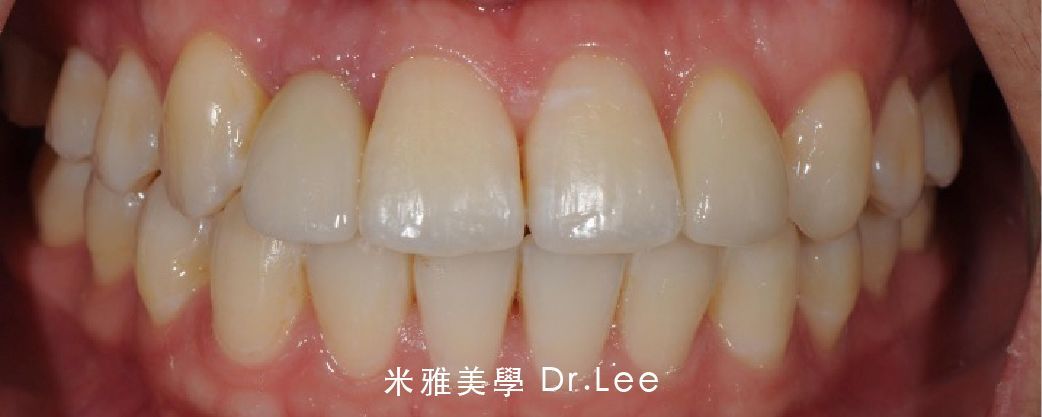 A close up of a person 's teeth with chinese writing on it.