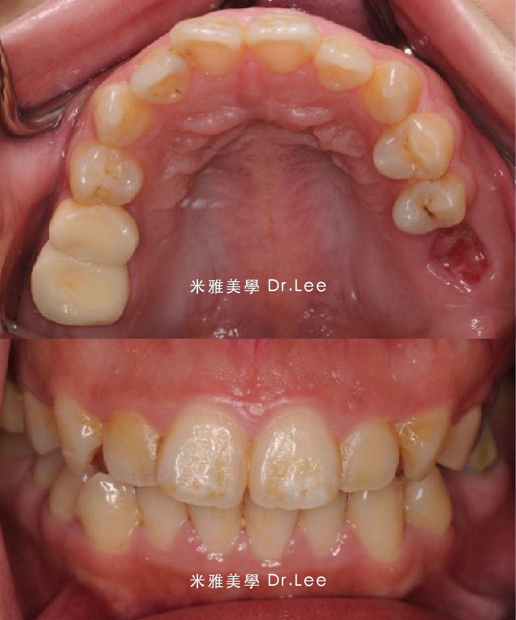 A close up of a person 's teeth with dr lee written on the bottom