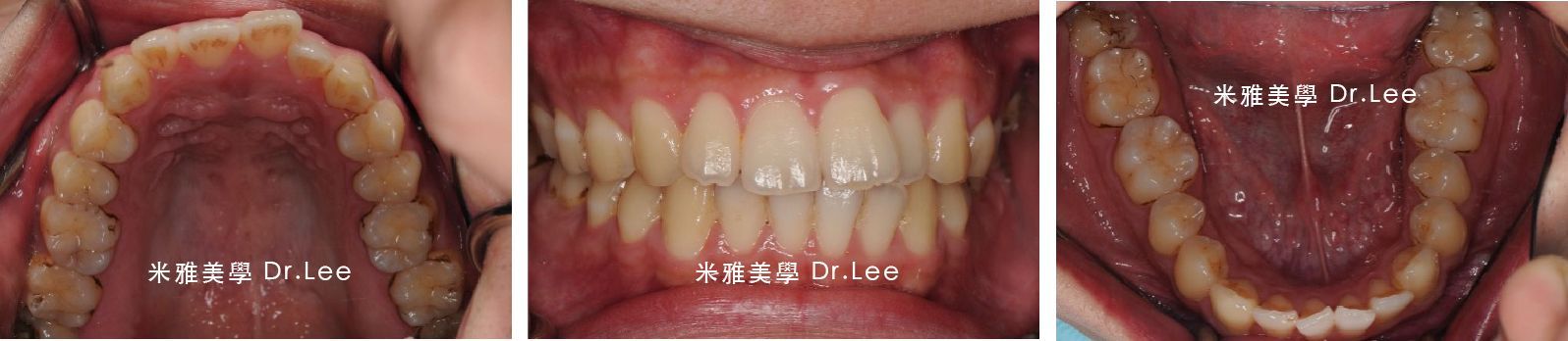 A close up of a person 's mouth showing their teeth.