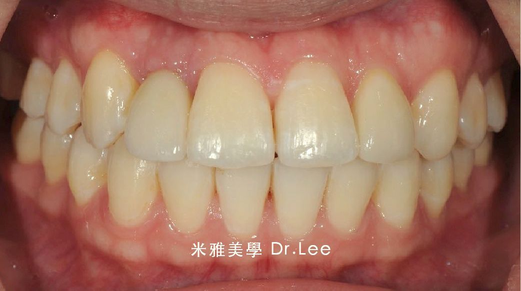 A close up of a person 's teeth with dr. loo written on the bottom