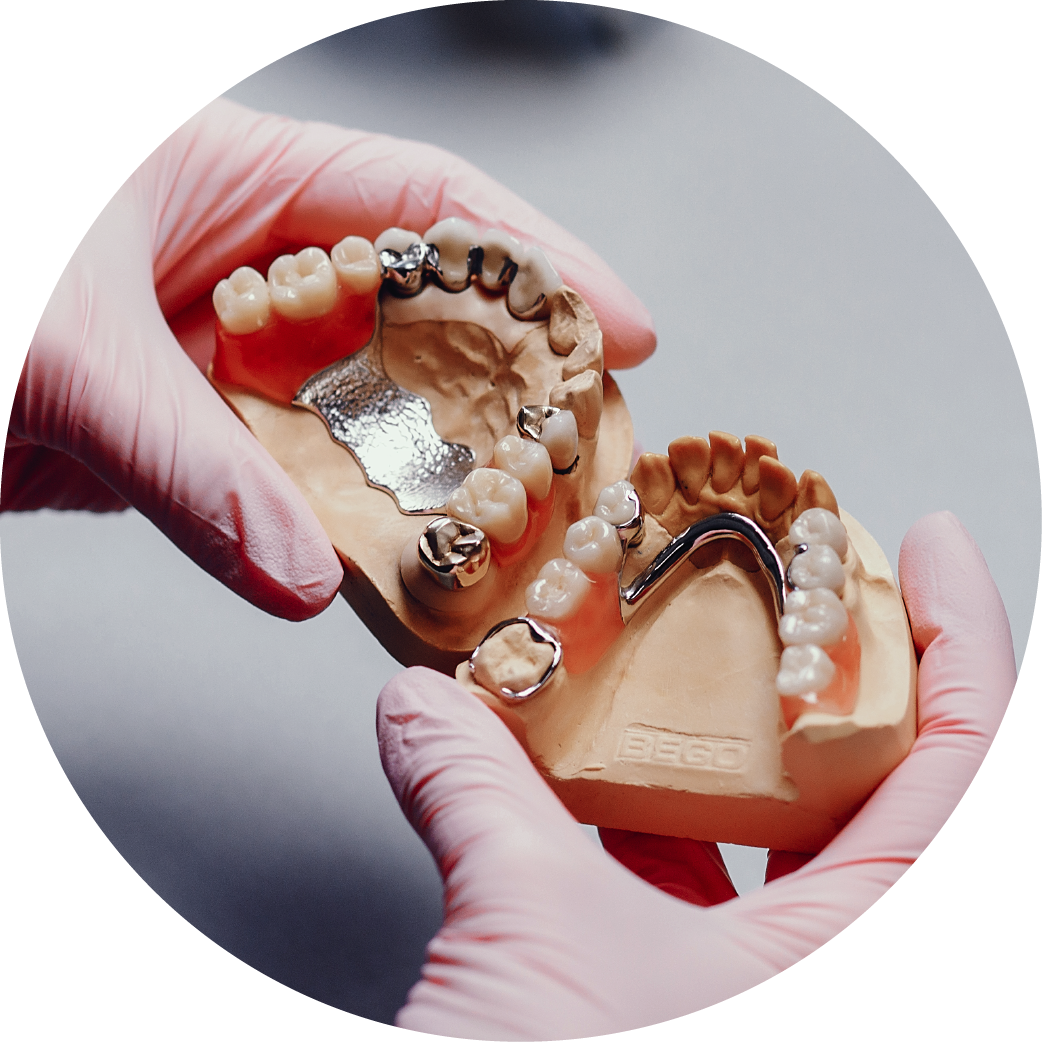 A person is holding a model of teeth in their hands.
