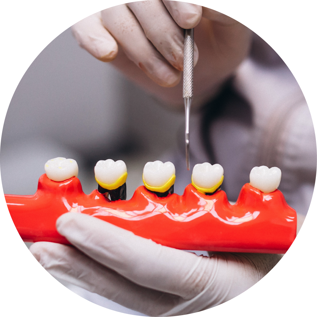 A person is holding a model of teeth in their hands