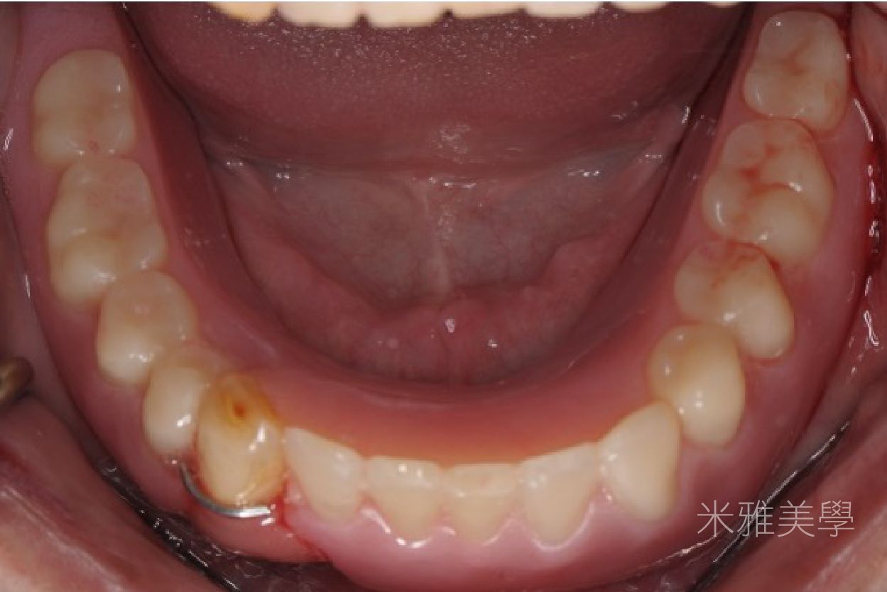 A close up of a person 's mouth with chinese writing on it