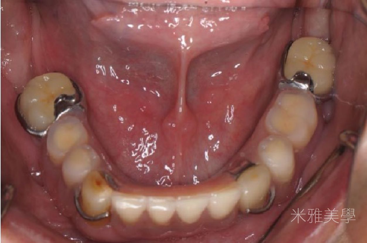 A close up of a person 's mouth with a lot of teeth