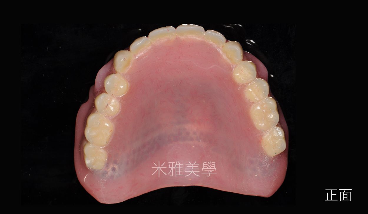 A close up of a denture with chinese writing on it