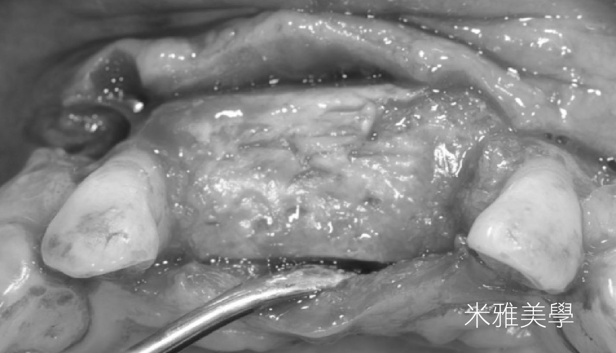A black and white photo of a person 's mouth with a fork in it.