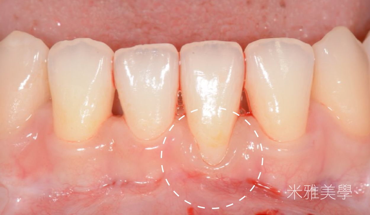 teeth