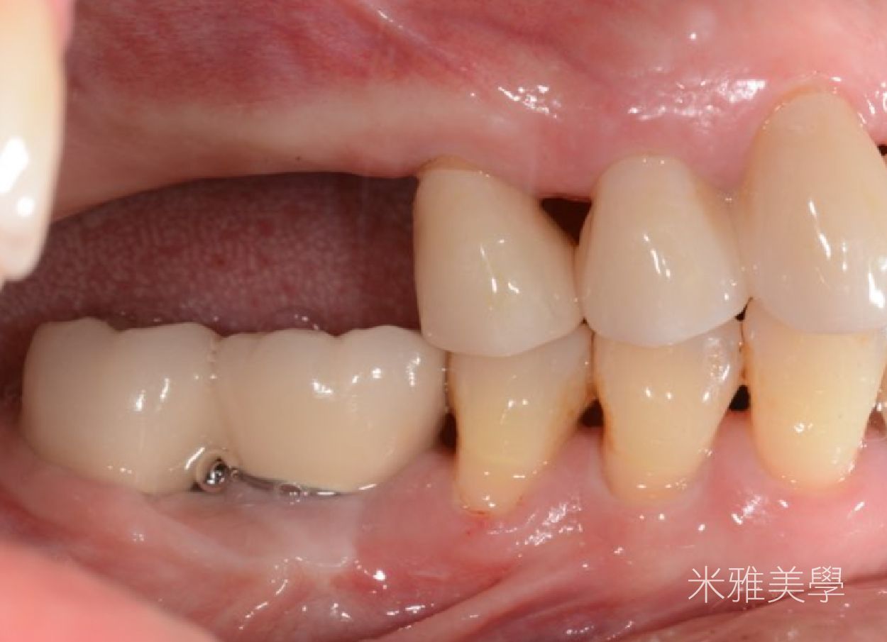 A close up of a person 's teeth with chinese writing on it