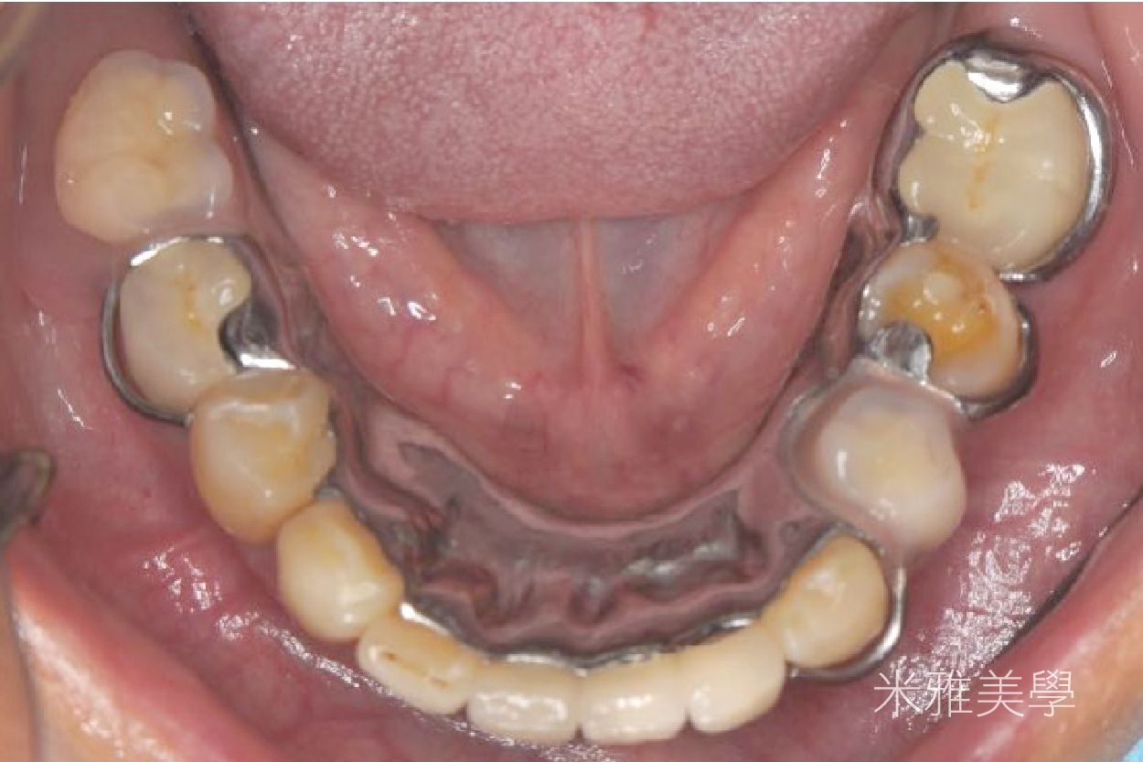 A close up of a person 's mouth with a lot of teeth