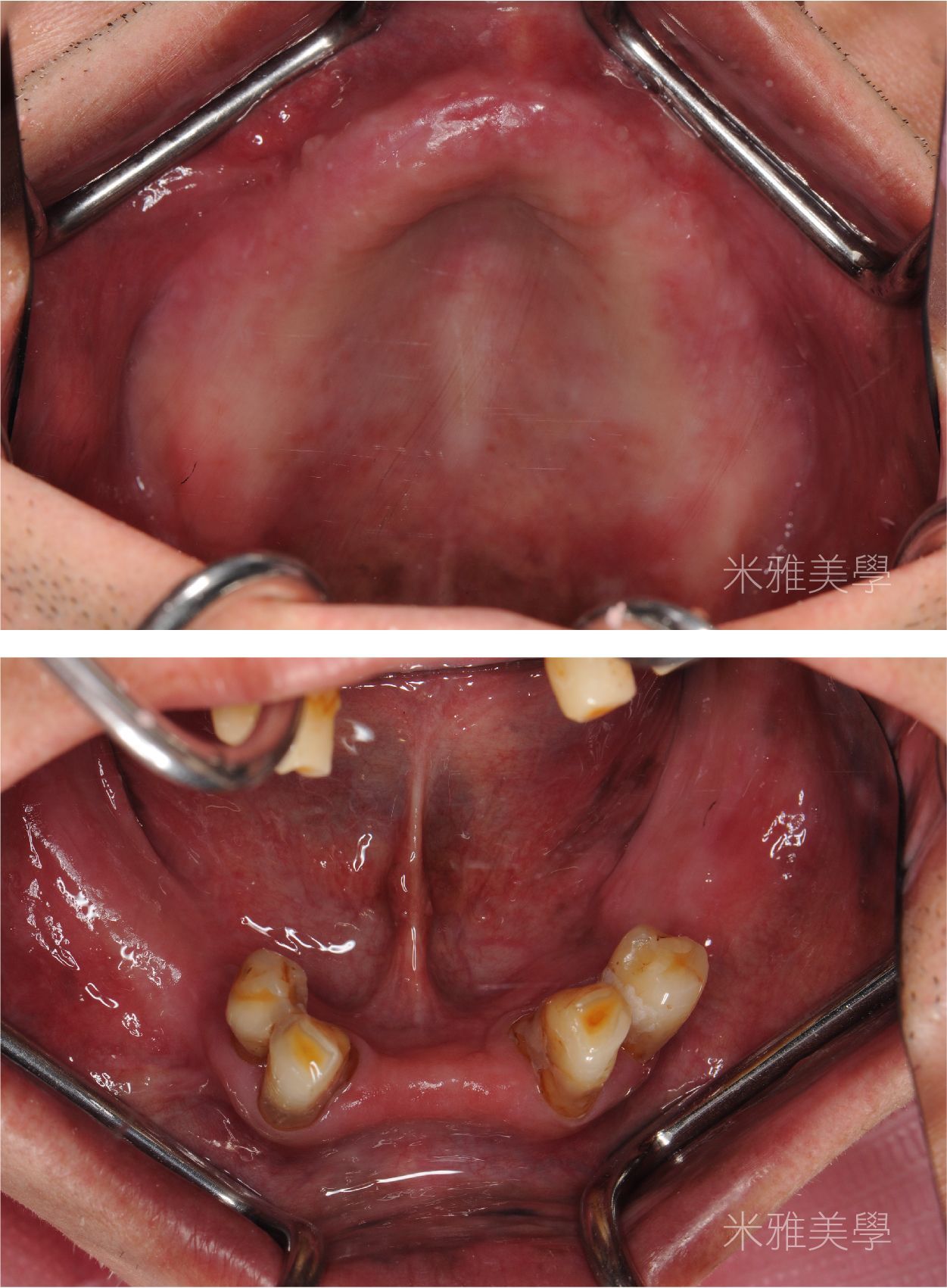A close up of a person 's mouth with a toothpick in it