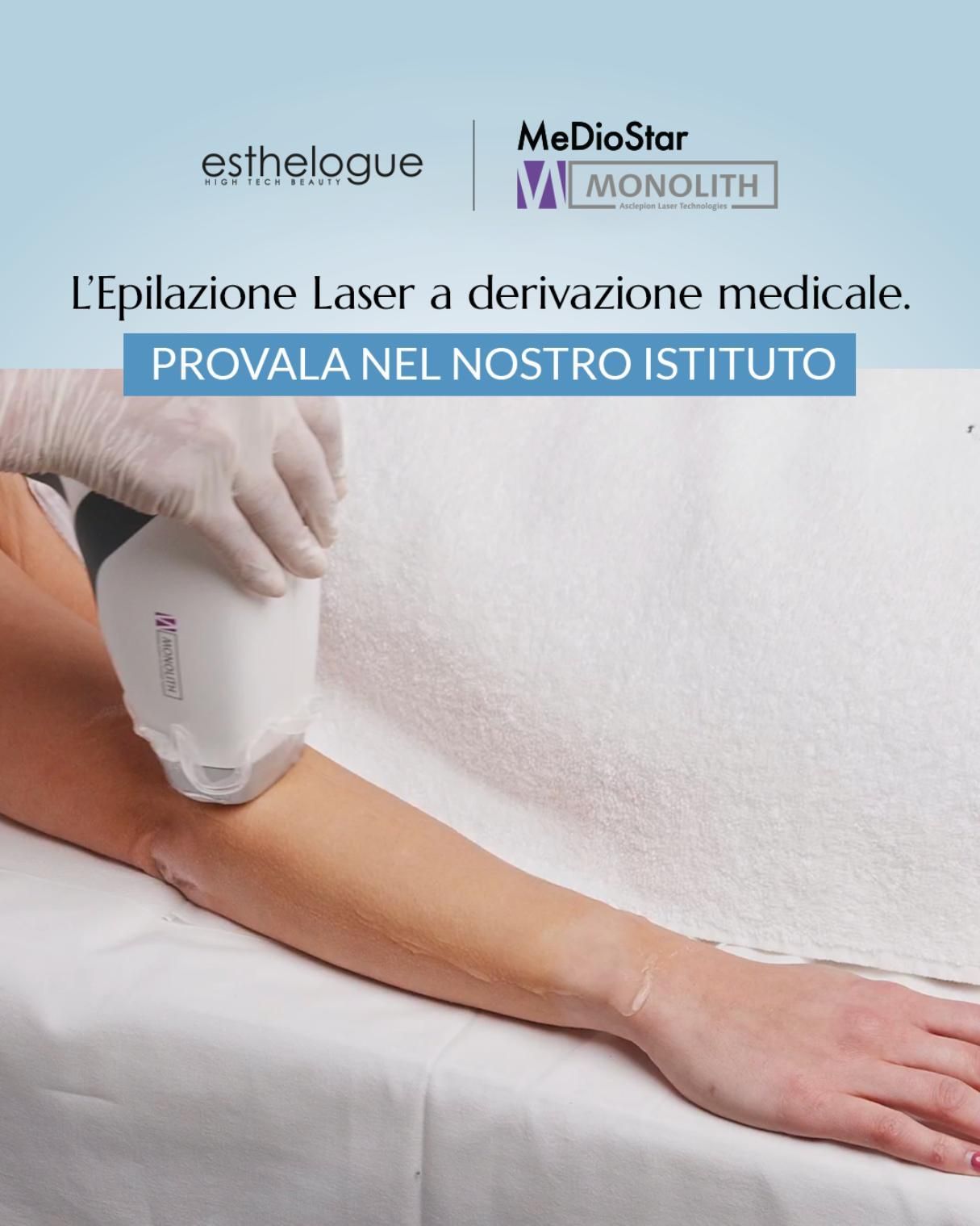 Epilazione laser sul braccio. Braccio di una persona con guanto bianco che tiene in mano il dispositivo laser. 