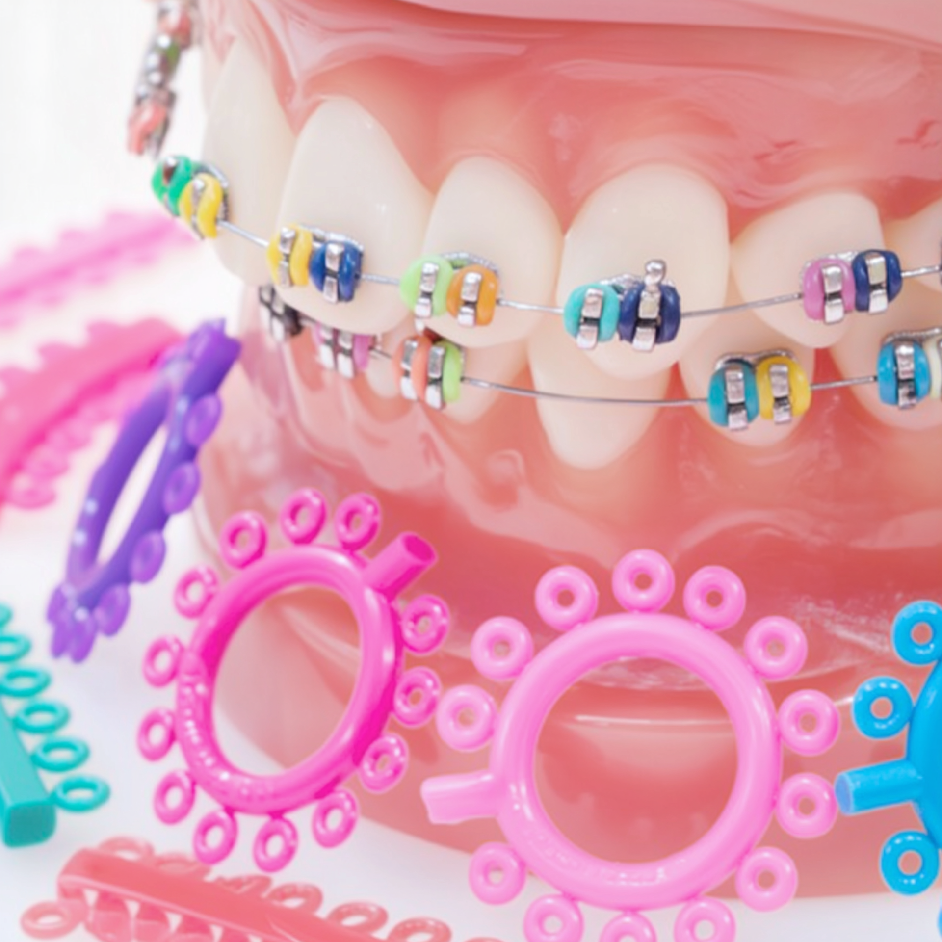 Close-up of teeth with colorful braces and assorted rubber bands for orthodontic treatment.