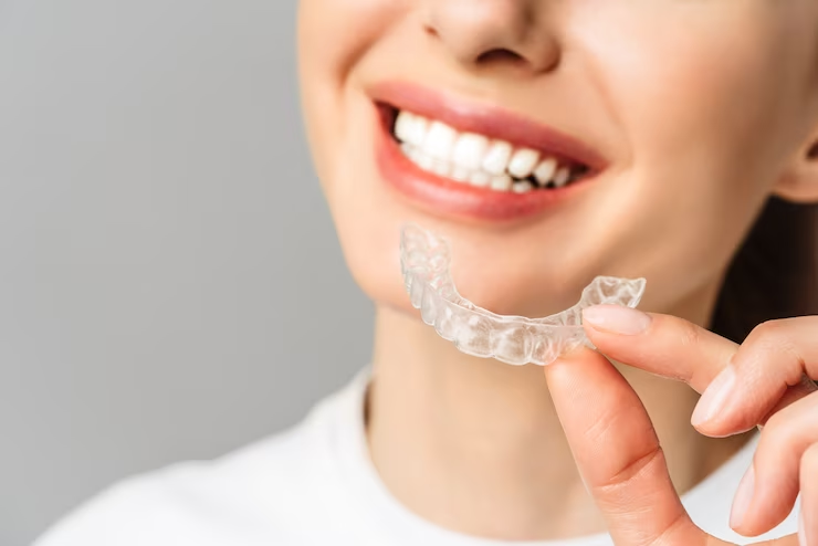 teeth+whitening_rand_dental_featured