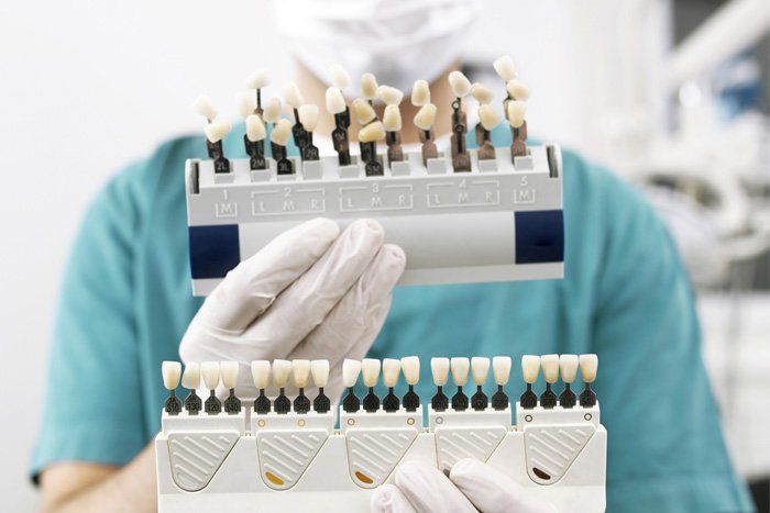 Dental Veneers — Spokane, WA — Dr. Michael Readel, D.D.S. Dental Veneers — Spokane, WA — Dr. Michael Readel, D.D.S.