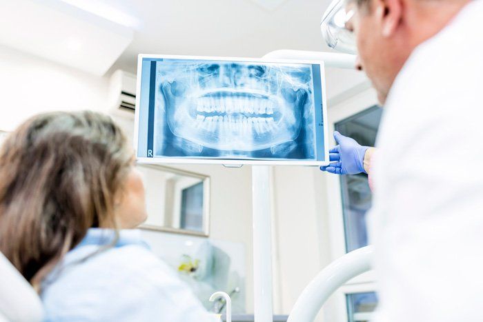 Examining Dental X-ray — Spokane, WA — Dr. Michael Readel, D.D.S. Examining Dental X-ray — Spokane, WA — Dr. Michael Readel, D.D.S.