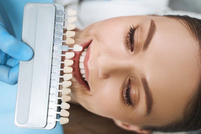 Dental Cosmetics — Spokane, WA — Dr. Michael Readel, D.D.S.