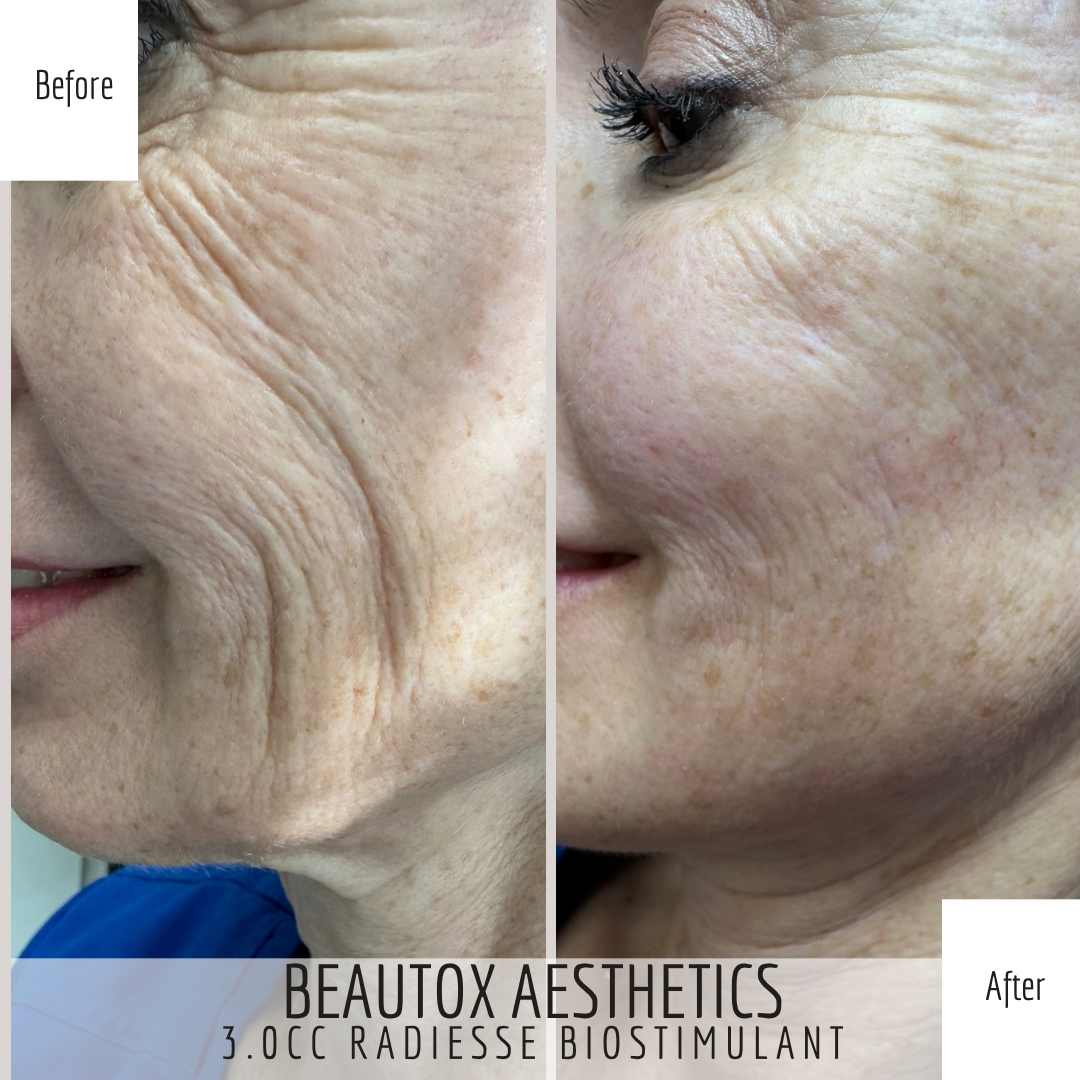 A before and after photo of a woman 's face.