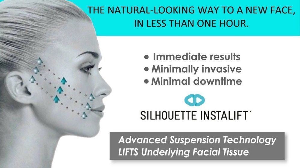 An advertisement for silhouette instalift advanced suspension technology lifts underlying facial tissue