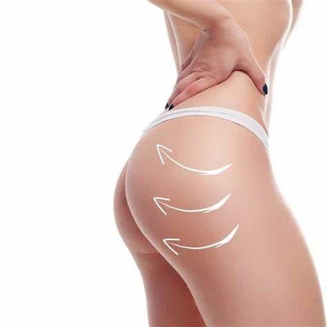 Body contouring with Morpheus 8