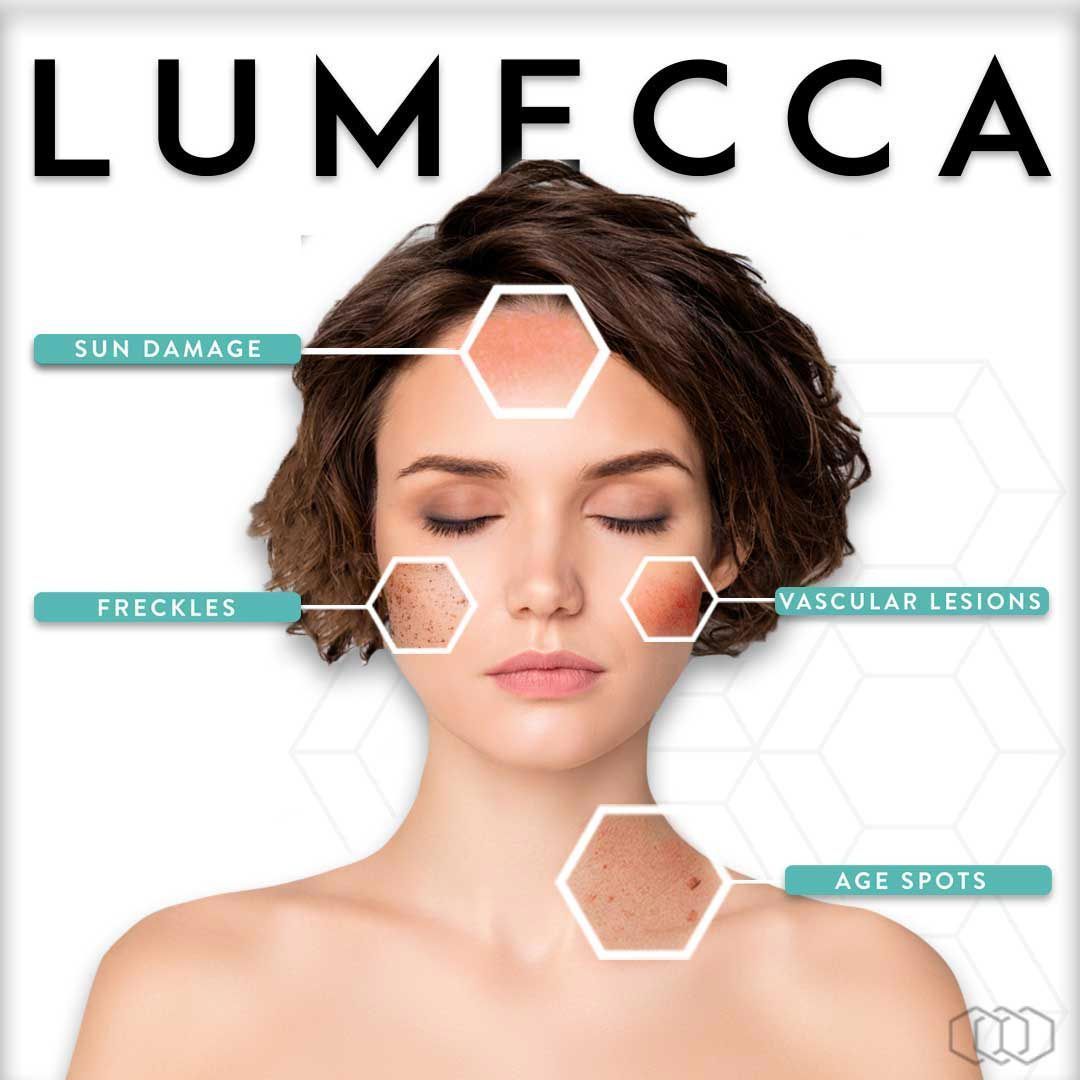A woman 's face is shown on a poster for lumecca
