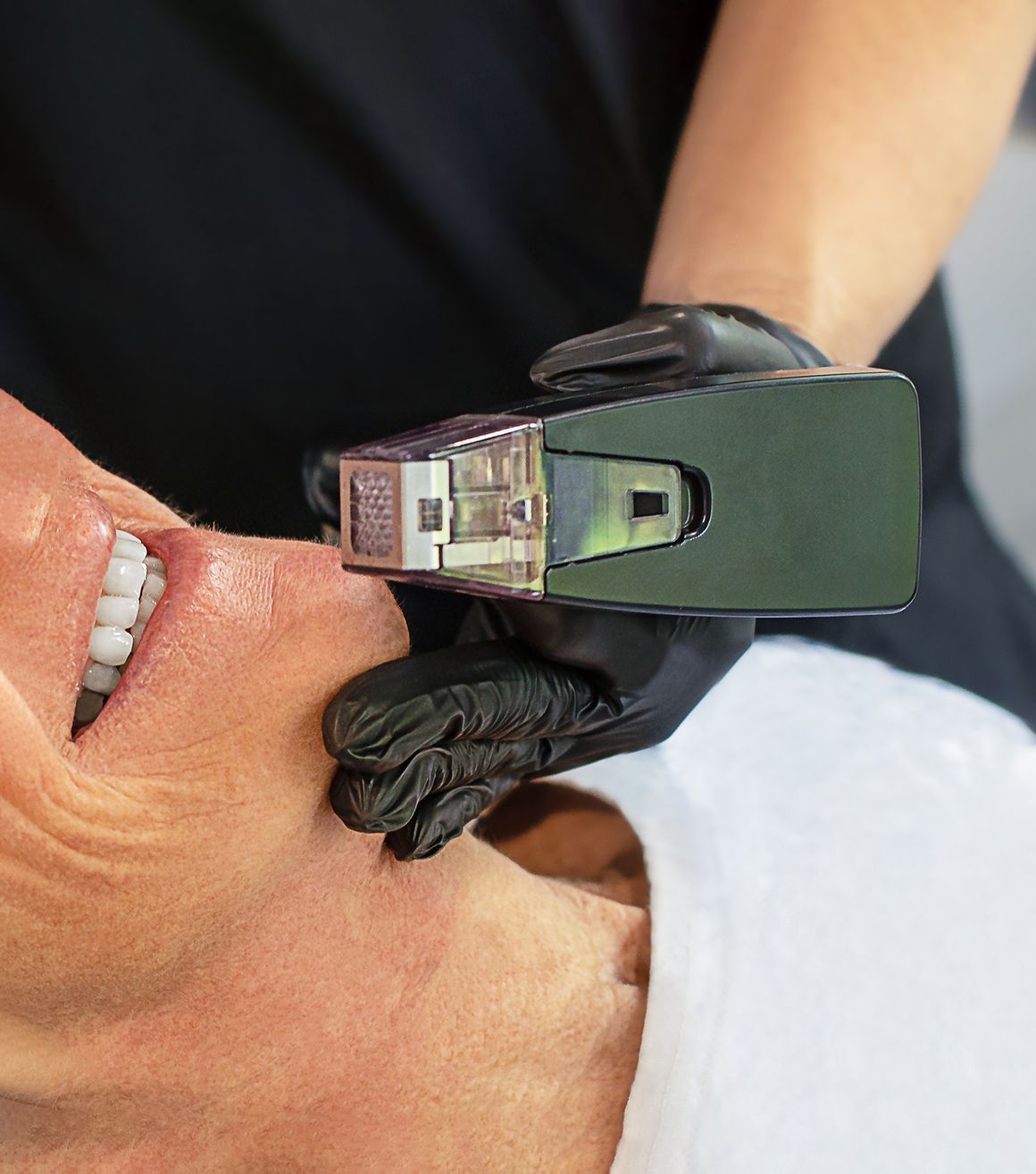 A woman is getting a laser treatment on her face.