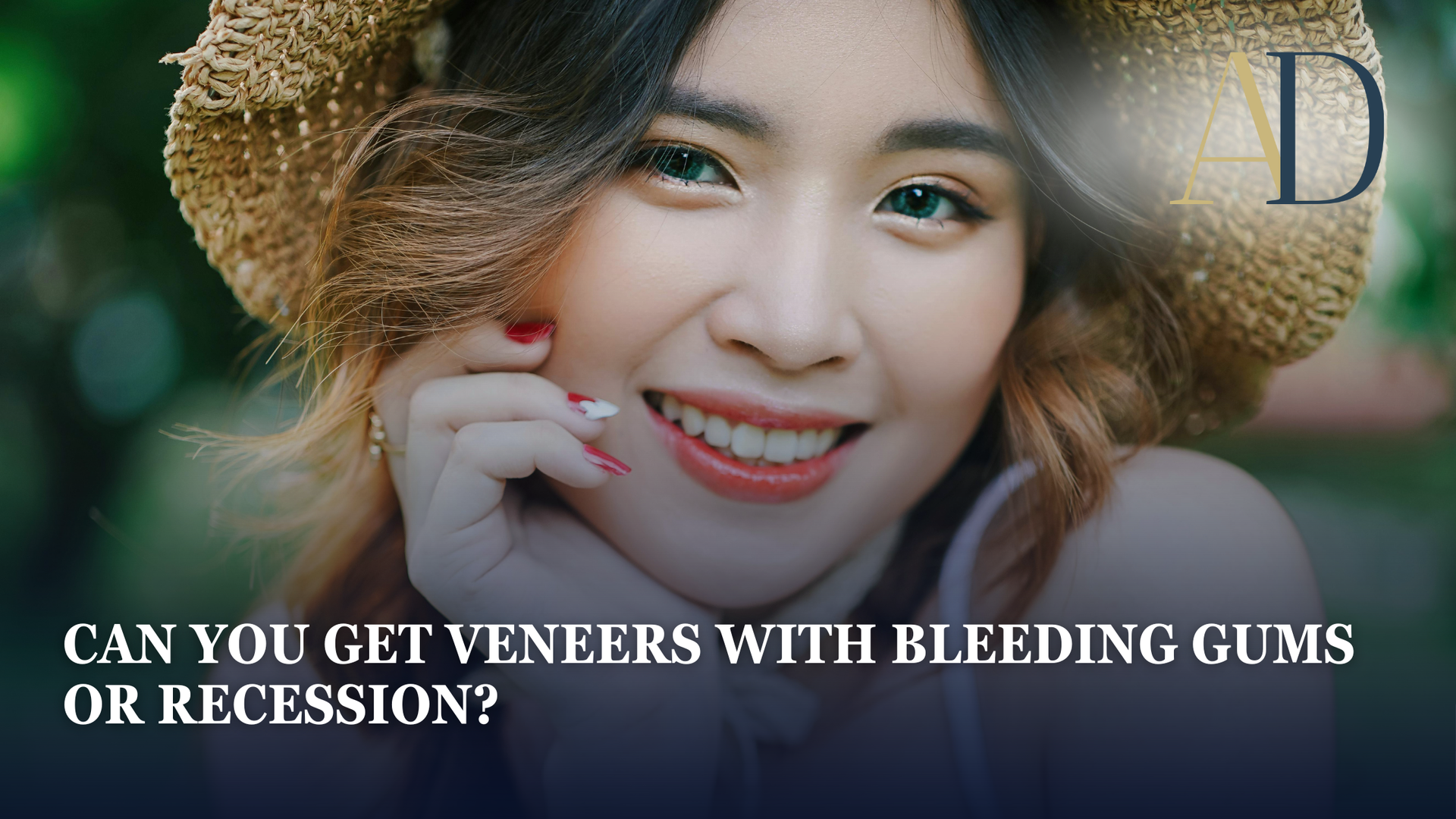 Smiling woman in a straw hat with text asking, “Can you get veneers with bleeding gums or recession?”