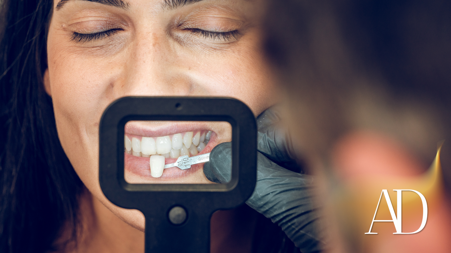 Close-up of teeth being examined through a magnifier, with a woman’s face in the background