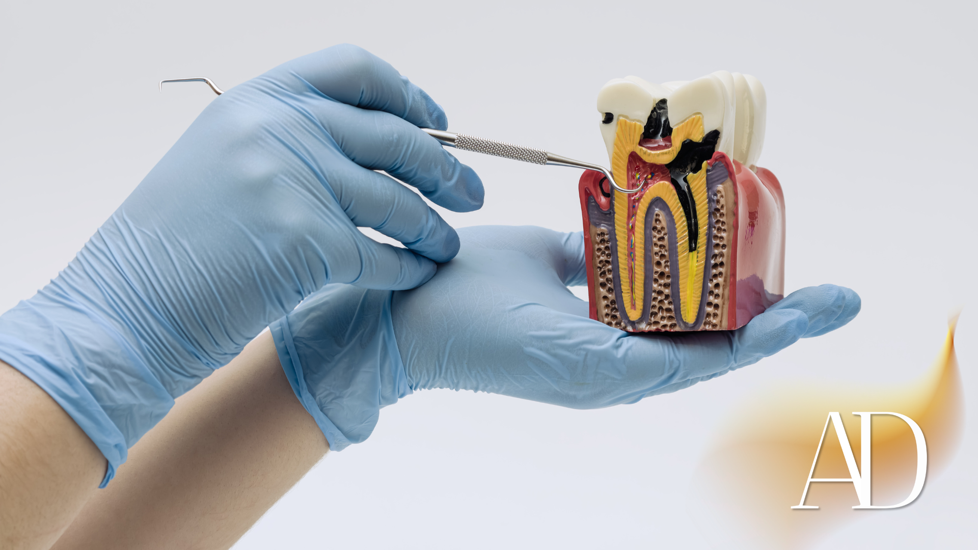 Gloved hands holding a dental tool next to a tooth anatomy model on a white background