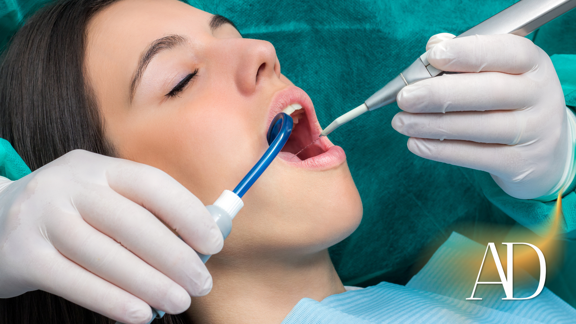 Dentist cleaning a patient’s teeth with tools in a clinical setting