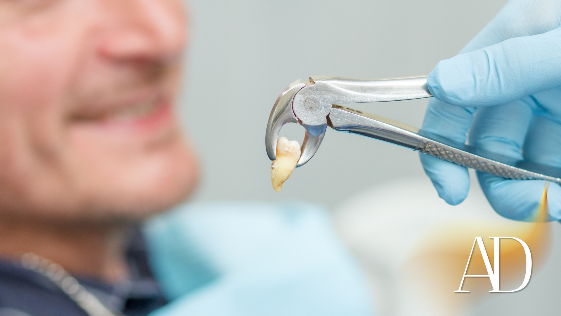 Dental tool holding a tooth filling near a patient’s mouth, with a gloved hand in a clinic setting