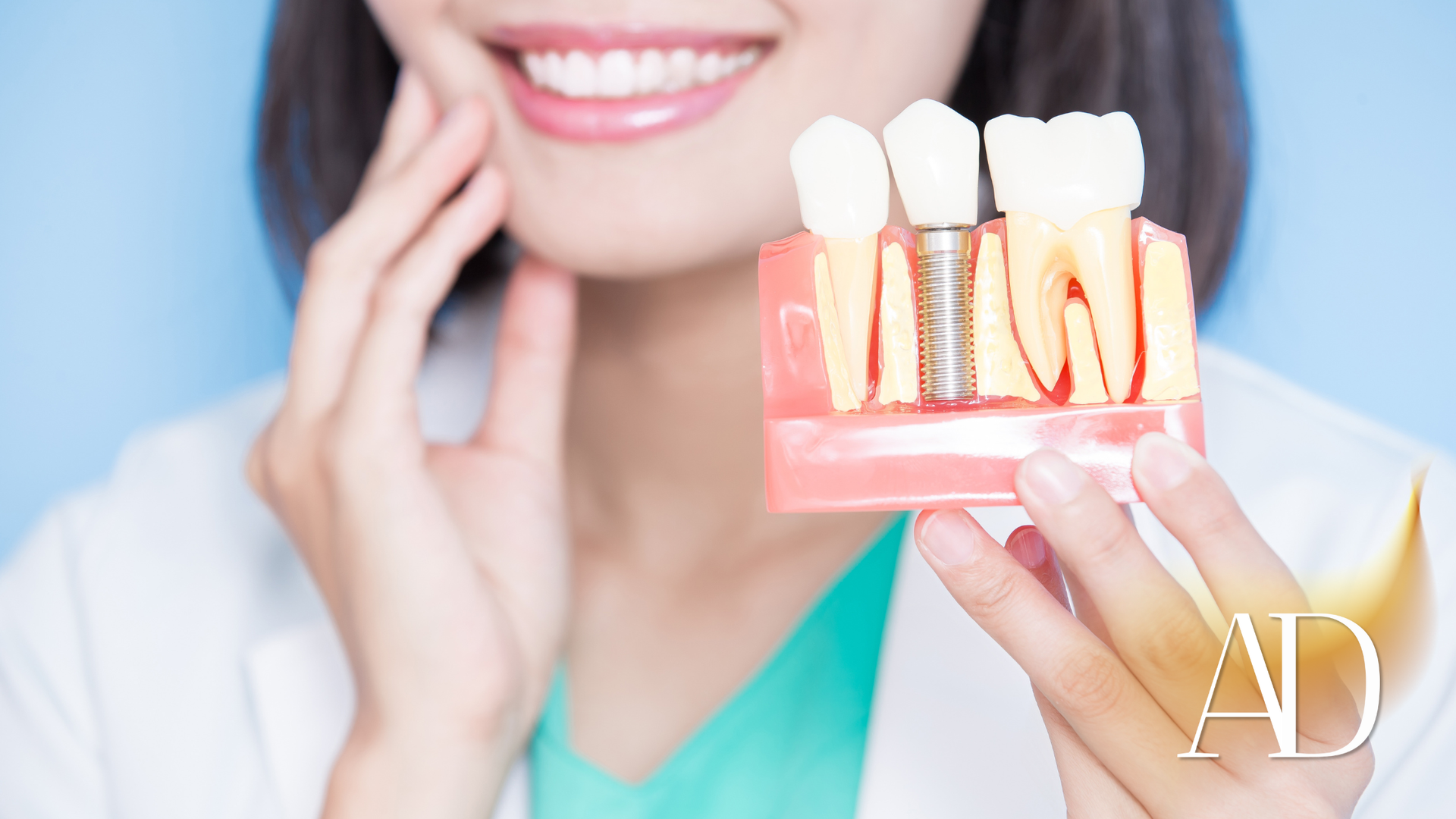 Dentist displaying a dental implant model beside a smiling patient’s mouth