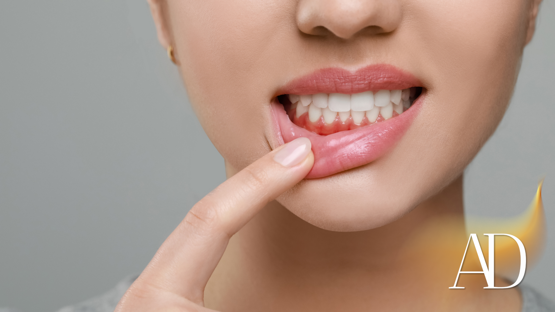 Close-up of lips with a finger pulling down the lower lip to show white teeth and gums
