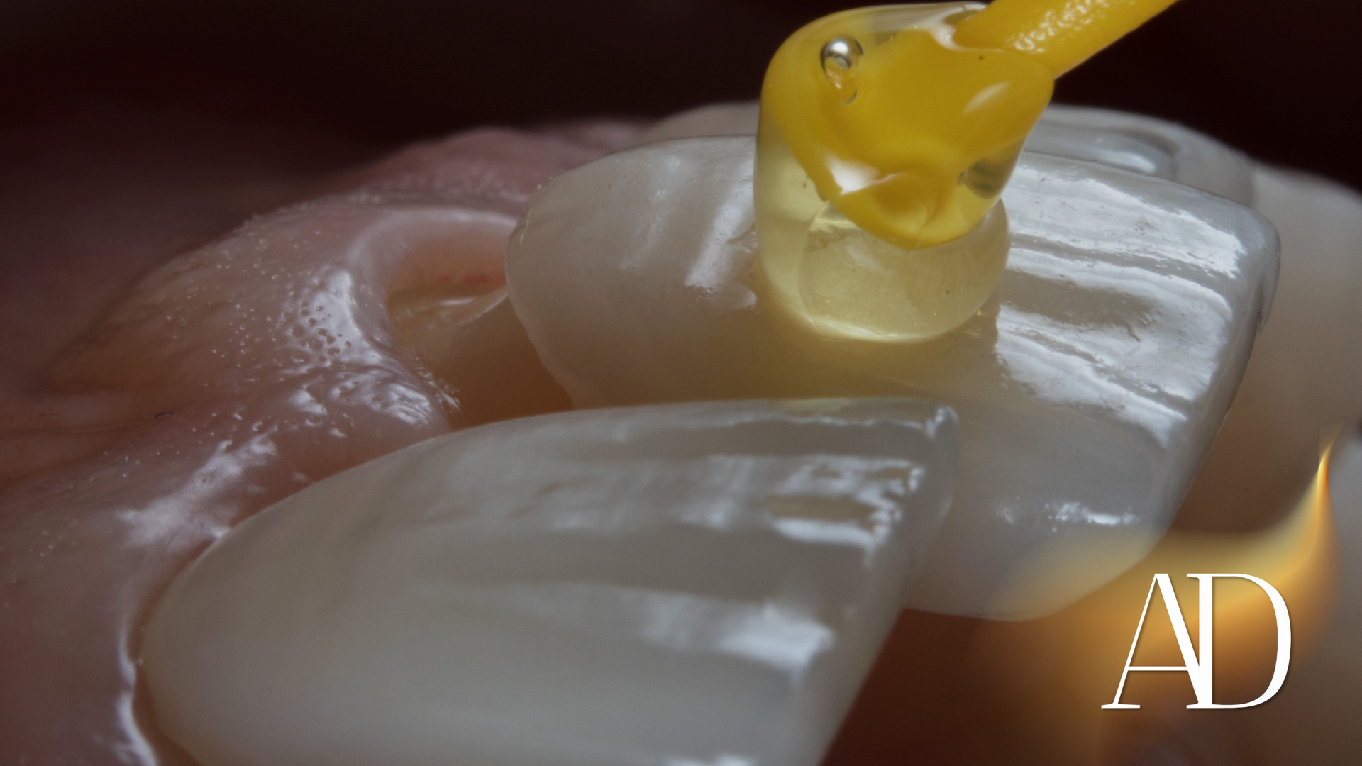 Close-up of a yellow dental tool polishing a white molar on wet gums
