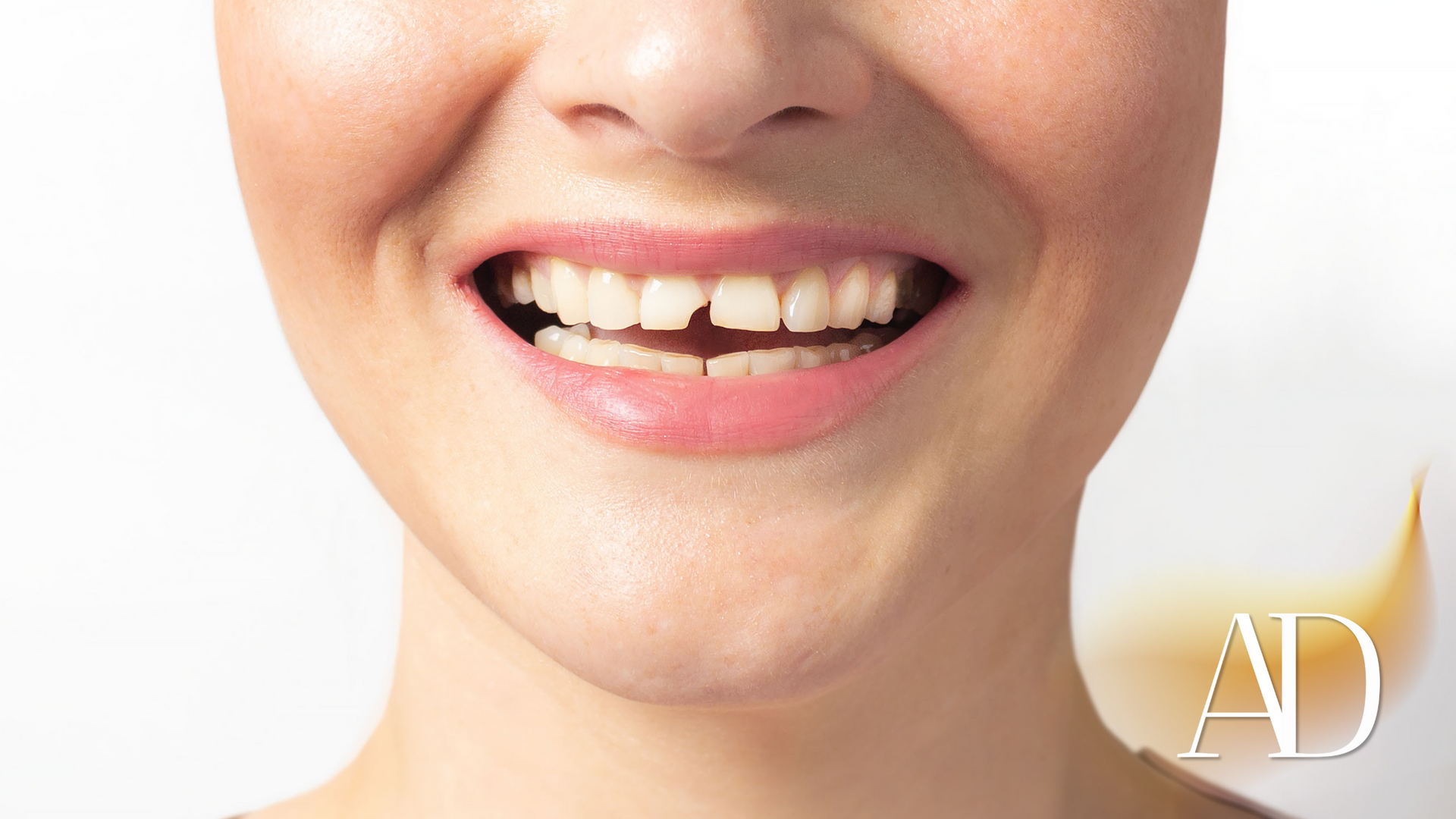 Close-up of a smiling mouth with white teeth and pink lips against a light background