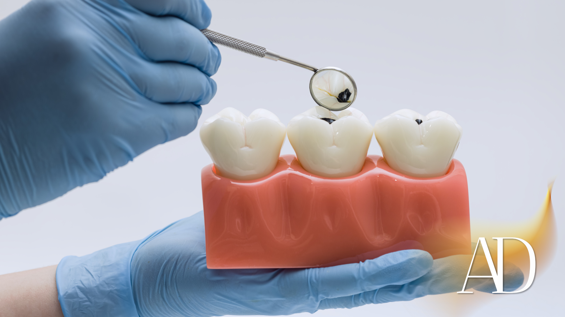 Gloved hands holding dental tool near model teeth with pink gums, showing dental procedure illustration