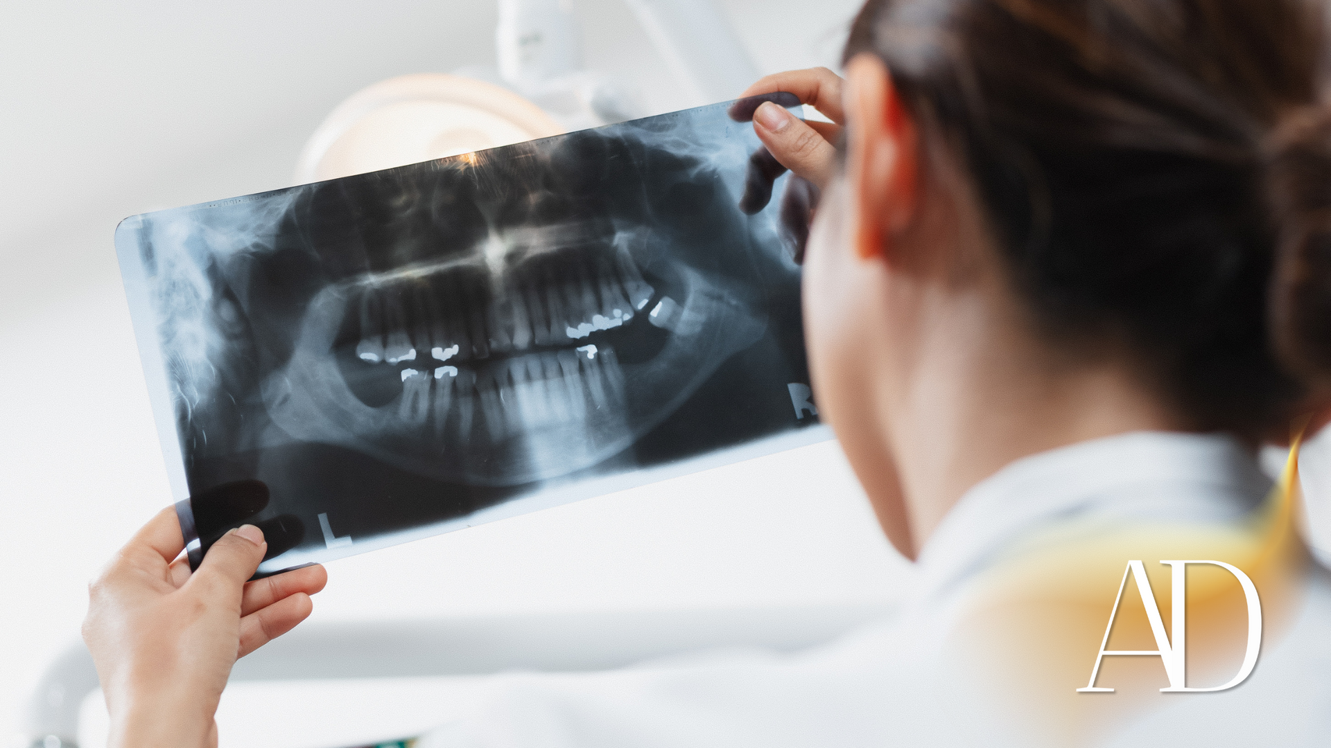 Dentist examining a dental X-ray on a lightbox in a clinical setting