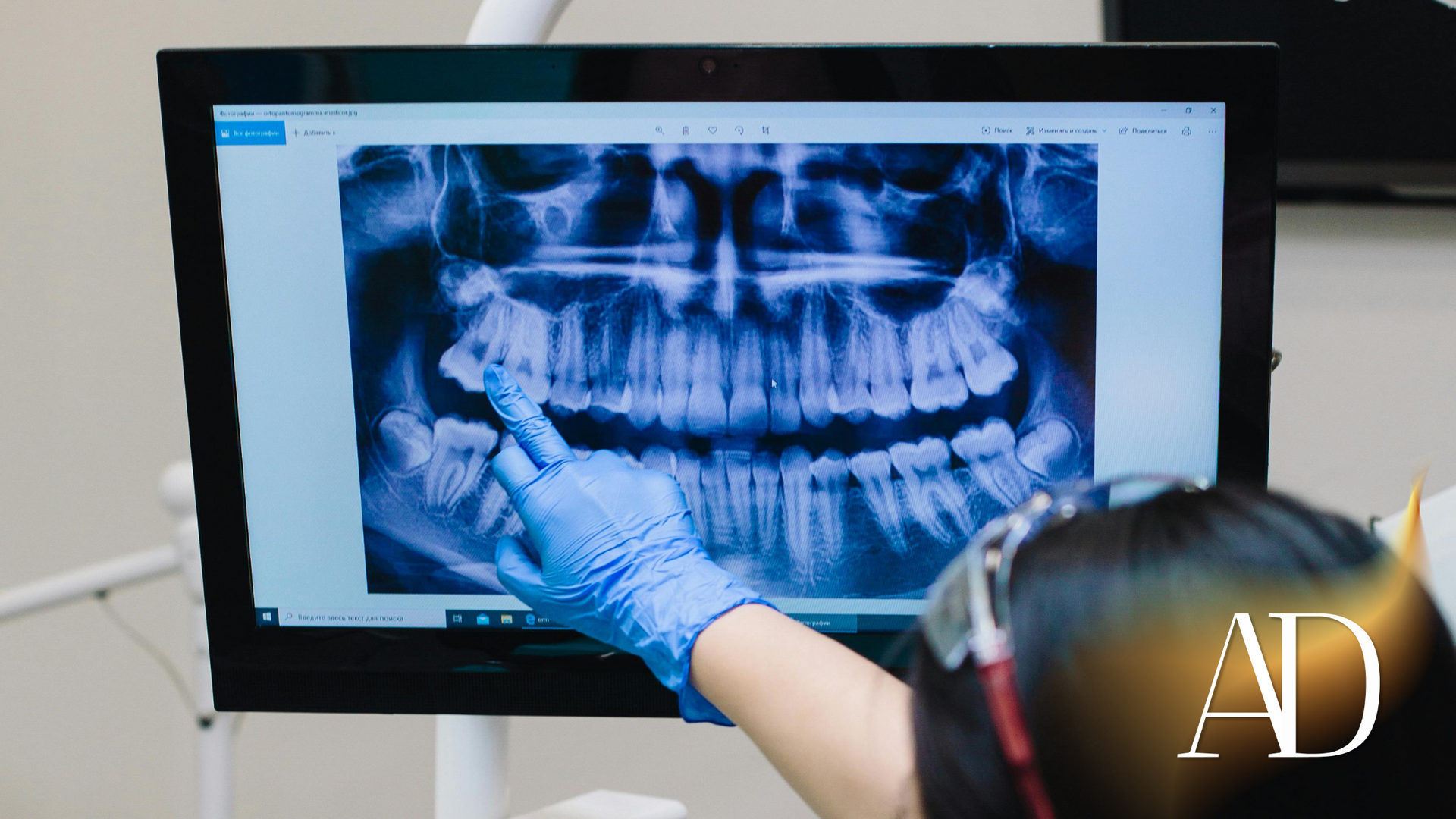Dentist examining a dental X-ray on a computer monitor with gloved hand