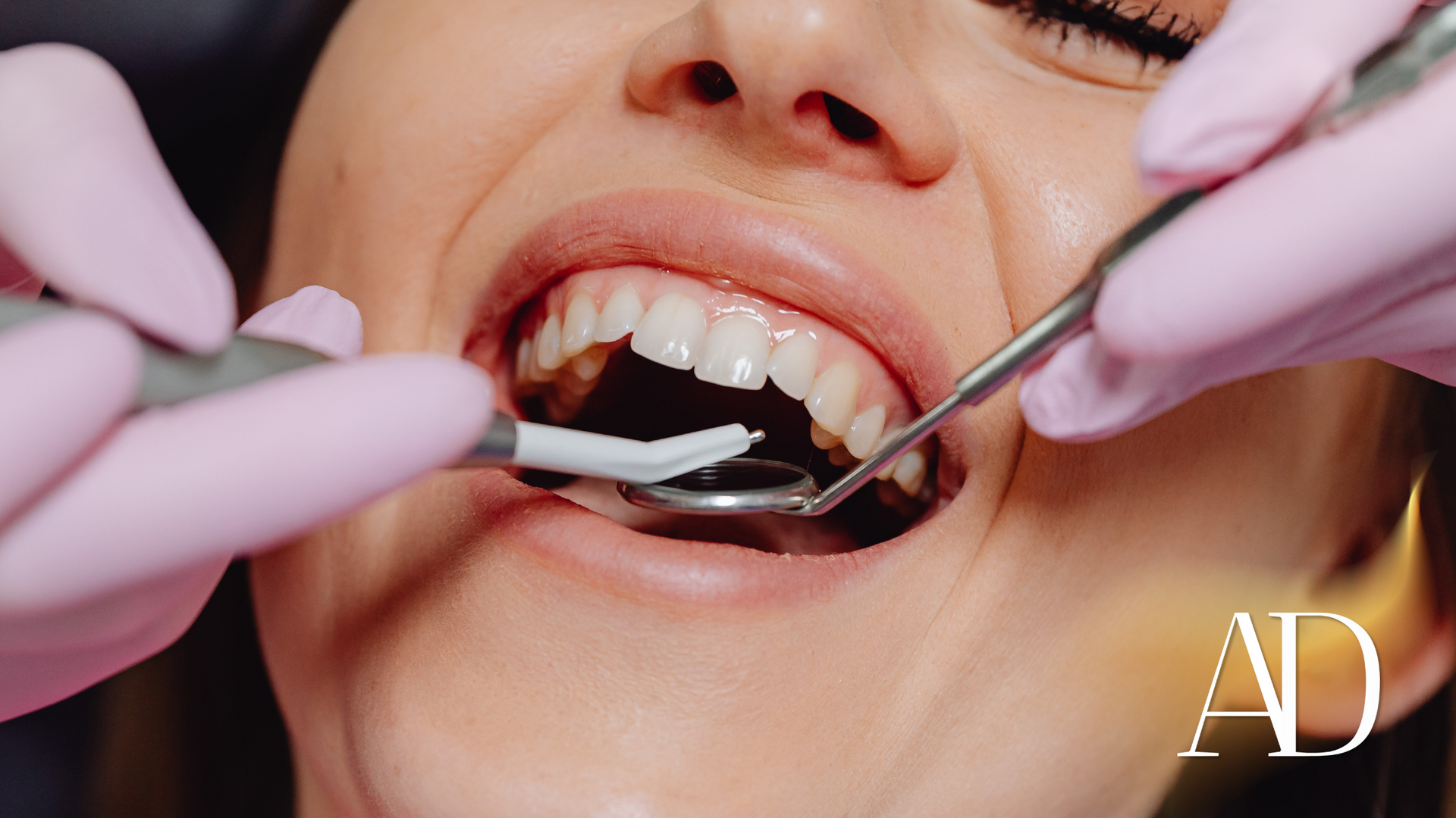 Dentist using mirror and tools inside a patient’s open mouth, wearing pink gloves